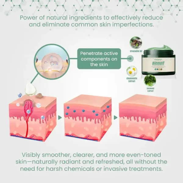 Ceoerty® BlemOff Instant Spot and Mole Remover Gel