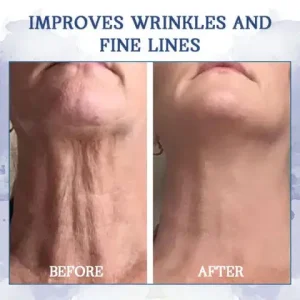 LOVILDS® Advanced Firming & Wrinkle-Reducing Cream: Restore Skin Elasticity 22 LOVILDS® Advanced Firming & Wrinkle-Reducing Cream: Restore Skin Elasticity
