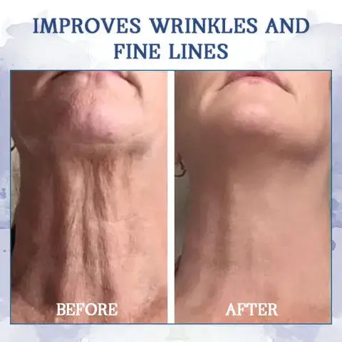 LOVILDS® Advanced Firming & Wrinkle-Reducing Cream: Restore Skin Elasticity 9 LOVILDS® Advanced Firming & Wrinkle-Reducing Cream: Restore Skin Elasticity