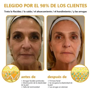 TLOPA™ Botox Firming Cream with Bee Venom 23 TLOPA™ Botox Firming Cream with Bee Venom