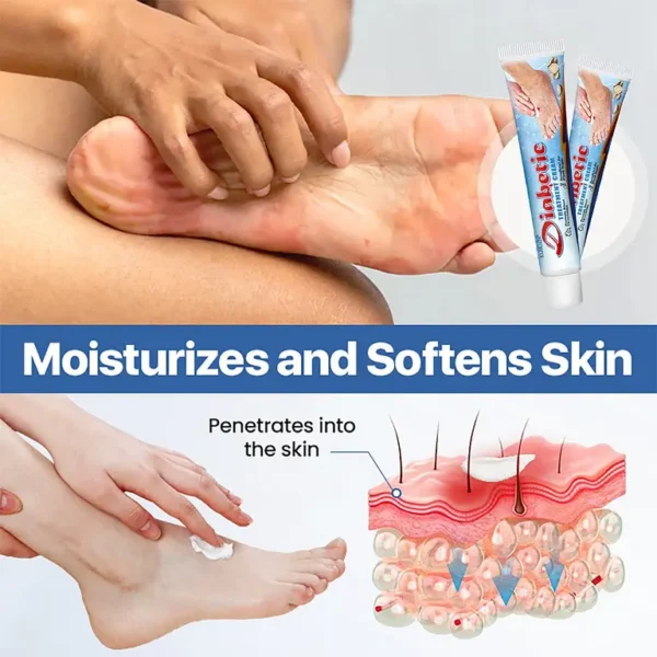 KUBOZN®VitaGluco Diabetes Treatment Cream