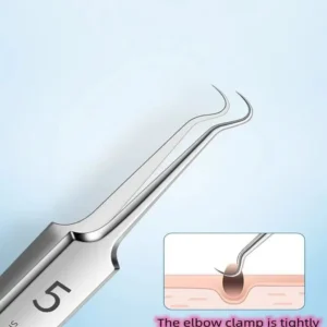 Professional Facial Blackhead Remover Tweezers
