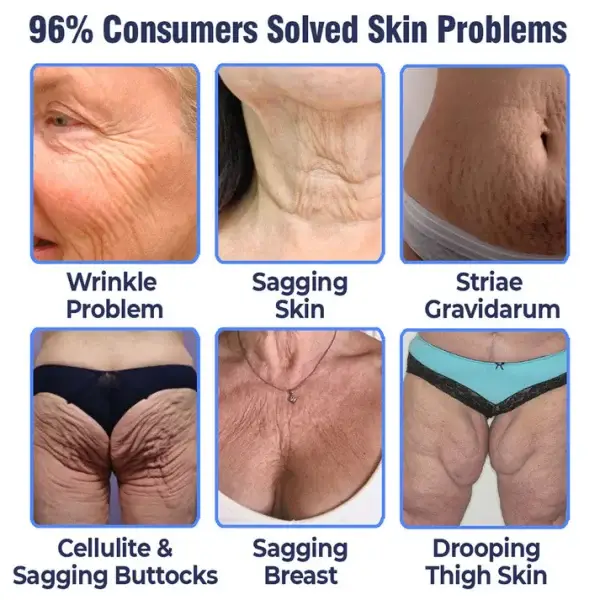 flysmus™ Advanced Tightening & Wrinkles Reducing Body Lotion (Made in AU) 4 flysmus™ Advanced Tightening & Wrinkles Reducing Body Lotion (Made in AU)