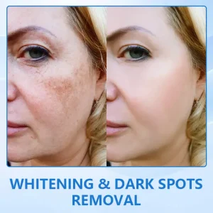 Ceoerty™ LuxeLift B5 Skin Firming Youth Butter 8 Ceoerty™ LuxeLift B5 Skin Firming Youth Butter