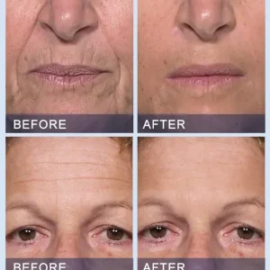 Big Savings Furzero™ All-in-One Lifting & Firming Serum 11 Big Savings Furzero™ All-in-One Lifting & Firming Serum