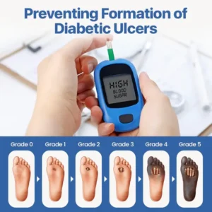 Insuvia™ VitaGluco Diabetes Treatment Cream
