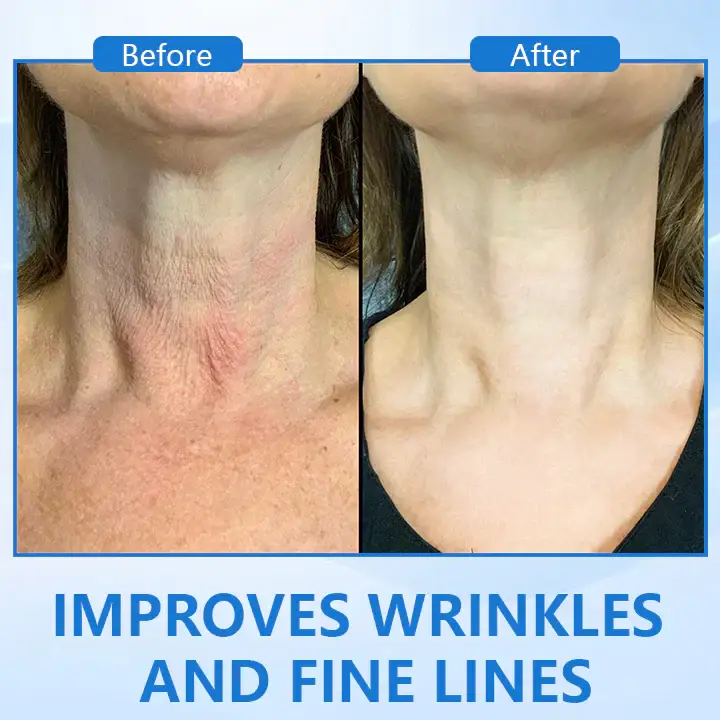 Ceoerty™ LuxeLift B5 Skin Firming Youth Butter 2 Ceoerty™ LuxeLift B5 Skin Firming Youth Butter