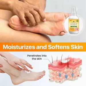 UNPREE™ Bee Venom Diabetic Wound Kolirin Spray 9 UNPREE™ Bee Venom Diabetic Wound Kolirin Spray