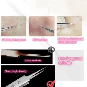 Professional Facial Blackhead Remover Tweezers