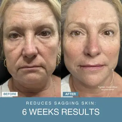 HZA Instant Skin Repair Gel 2 HZA Instant Skin Repair Gel