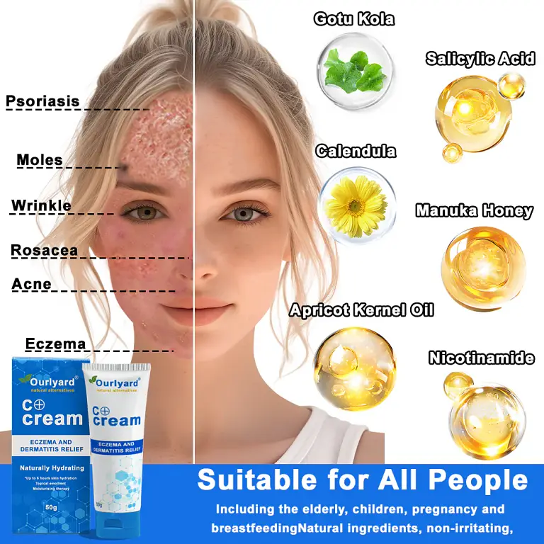 Ourlyard® Skin Treatment Cream 11 Ourlyard® Skin Treatment Cream