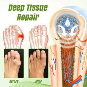 Ceoerty ReLaxaJoint Therapy Gel 11 Ceoerty ReLaxaJoint Therapy Gel