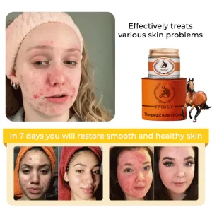 Fivfivgo™ Therapeutic Horse Oil Cream