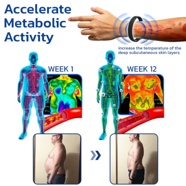 Furzero™ NumbMend Graphene Wristband