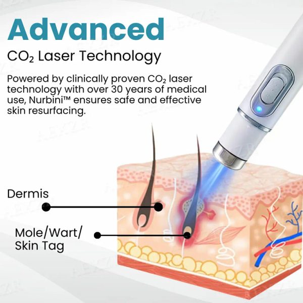 Nurbini® Non-Invasive Mole and Wart Removal Laser Pen