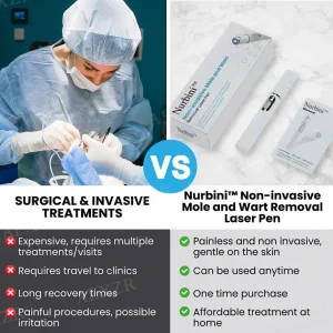 Nurbini® Non-Invasive Mole and Wart Removal Laser Pen
