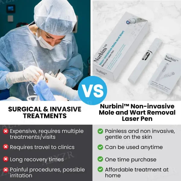 Nurbini® Non-Invasive Mole and Wart Removal Laser Pen
