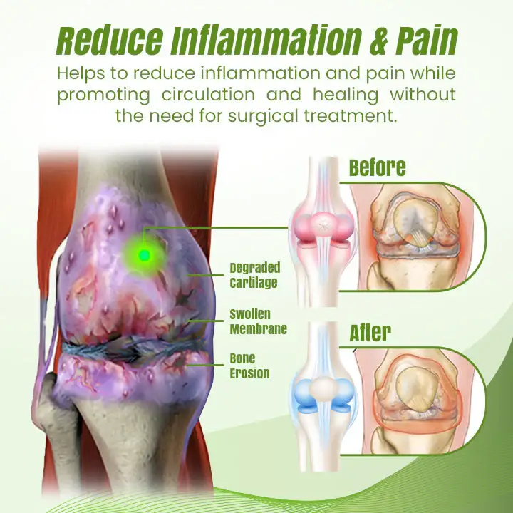 Ceoerty ReLaxaJoint Therapy Gel 2 Ceoerty ReLaxaJoint Therapy Gel