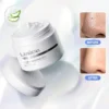 Lanbéna Blackhead Remover