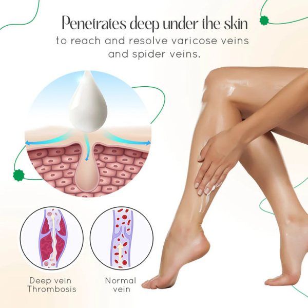 LOVILDS™ Vein Therapy Cream