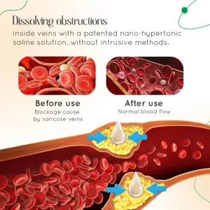 LOVILDS™ Vein Therapy Cream 13 LOVILDS™ Vein Therapy Cream