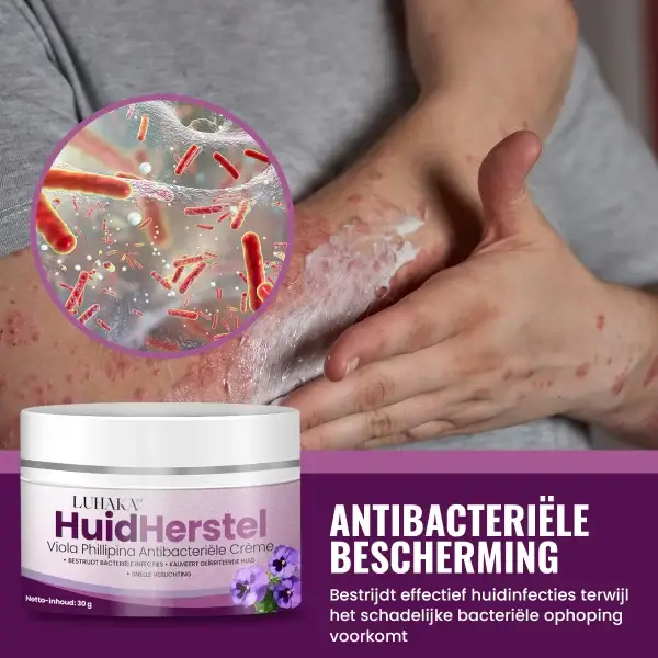Luhaka™ Skin Recovery Viola Phillipina Antibacterial Cream 4 Luhaka™ Skin Recovery Viola Phillipina Antibacterial Cream