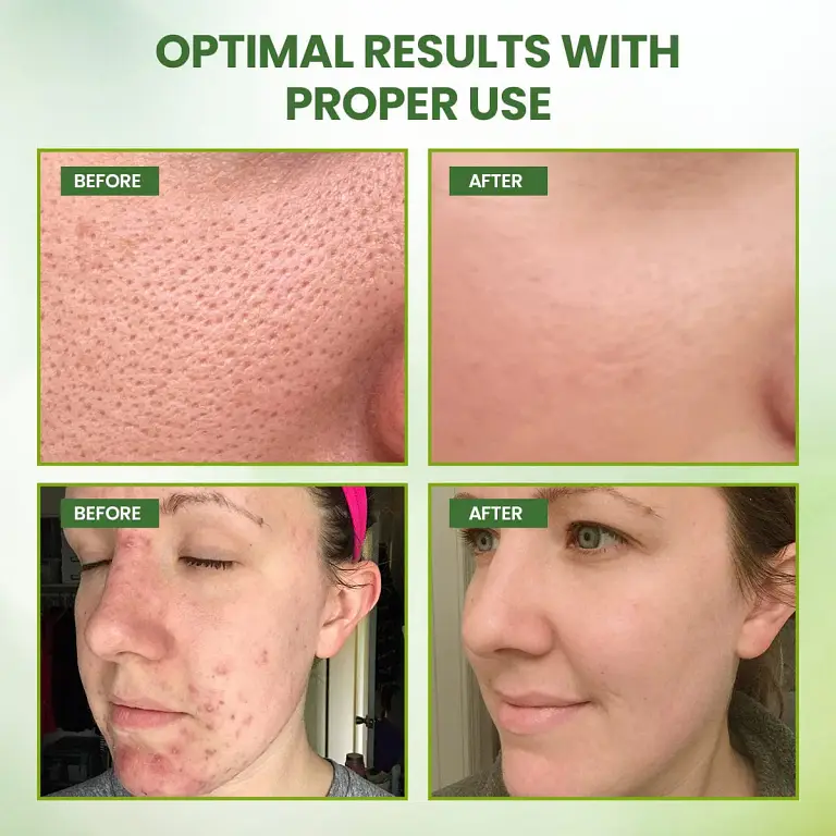 KISSHI™ Green Tea Mask Stick 3 KISSHI™ Green Tea Mask Stick