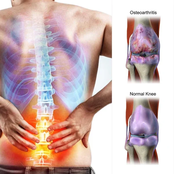coastglee™Shark Cartilage Joint Relief Cream