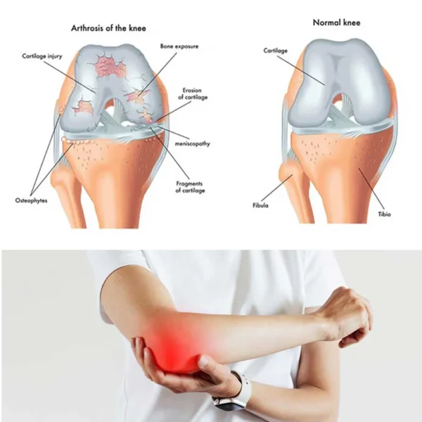 coastglee™Shark Cartilage Joint Relief Cream