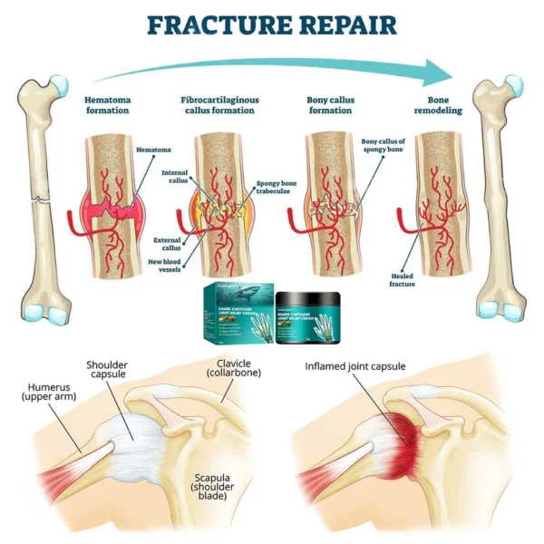 coastglee™Shark Cartilage Joint Relief Cream