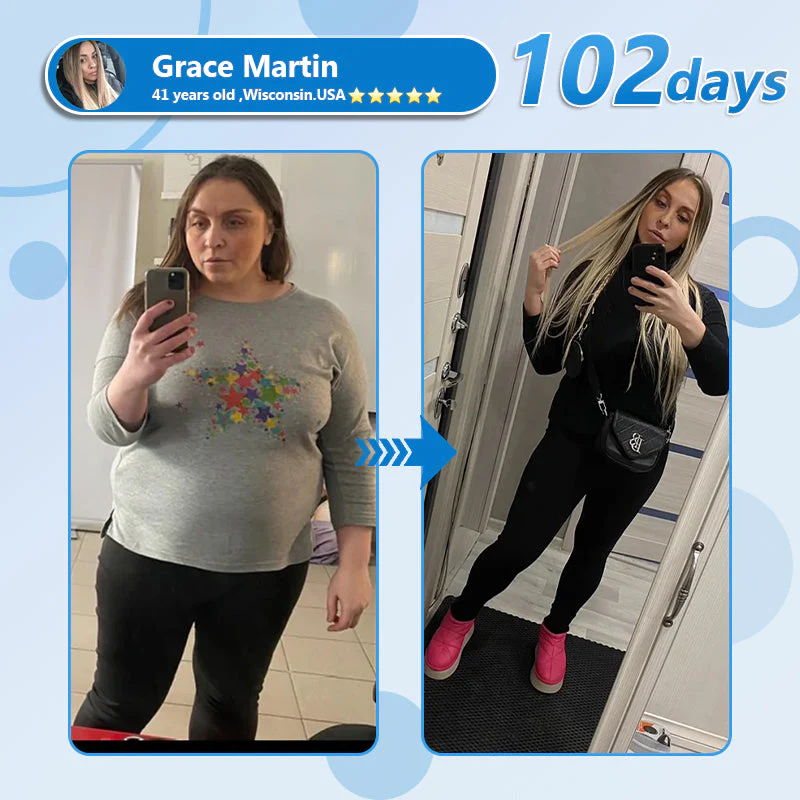 CROAIE Nano Microneedle Patch with SMGT-GLP-1 & Matrixyl 3000 – Slimming 4 CROAIE Nano Microneedle Patch with SMGT-GLP-1 & Matrixyl 3000 – Slimming