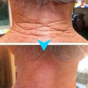Fubsta™ Firming Regenerating Serum