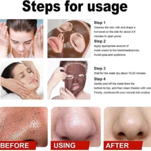 LOVILDS™ Whitening and Freckle - Removing Mask 29 LOVILDS™ Whitening and Freckle - Removing Mask