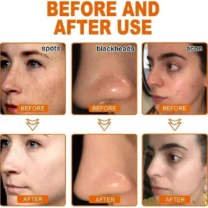 LOVILDS™ Whitening and Freckle - Removing Mask 28 LOVILDS™ Whitening and Freckle - Removing Mask