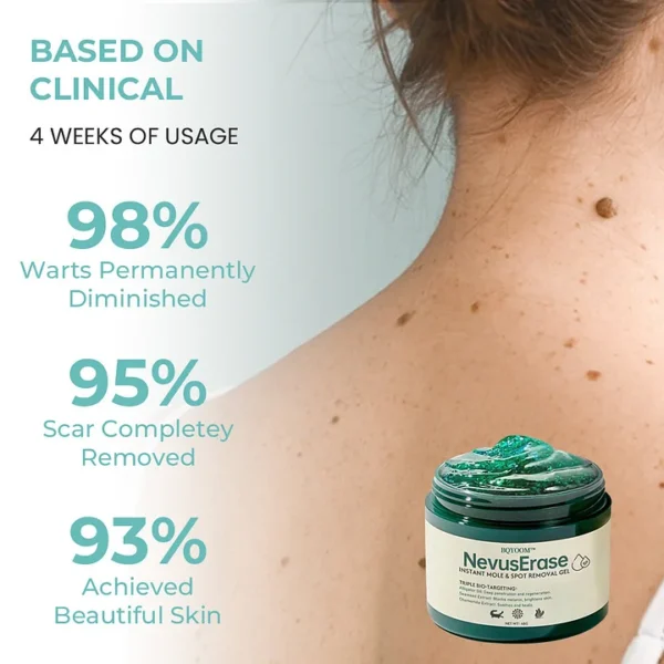 BQYOOM™ Nevus Erase Instant Mole & Spot Removal Gel