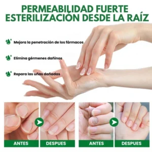 7 Days Fungus Free Nails® - Protects and eliminates nail fungus (50ml)