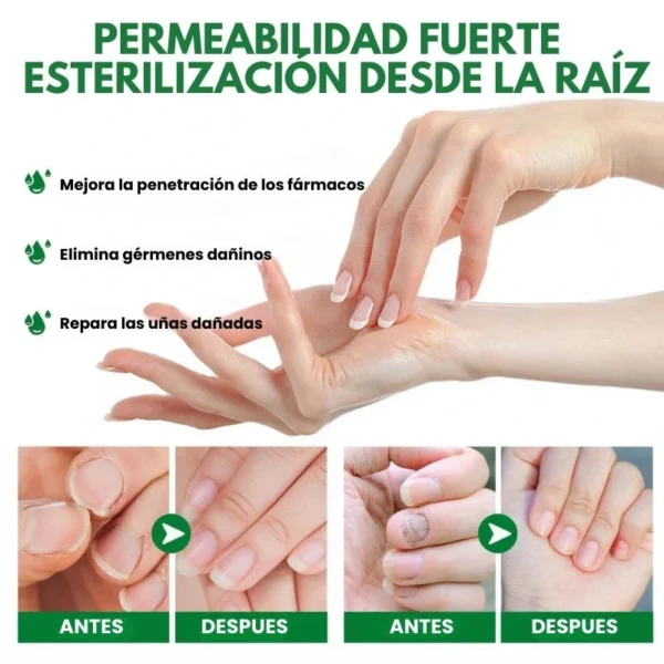 7 Days Fungus Free Nails® - Protects and eliminates nail fungus (50ml)