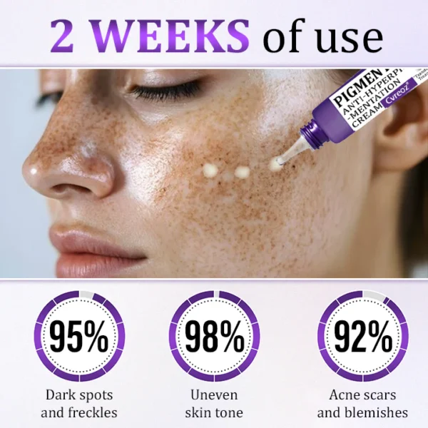 Cvreoz® PigmentaX ProFade Anti-Hyperpigmentation Cream