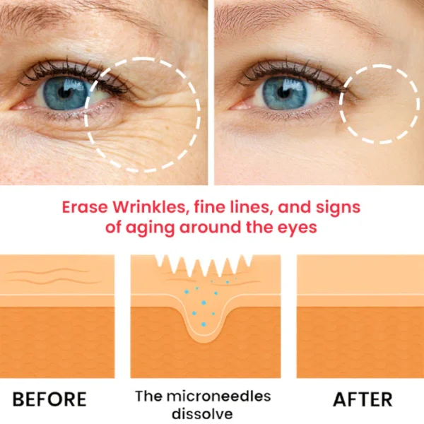 Dobshow® Snake Venom Peptide Microneedle Anti-Wrinkle and De-Puffing Eye Patch
