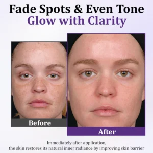 Cvreoz® PigmentaX ProFade Anti-Hyperpigmentation Cream