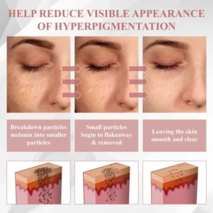 ATTDX® Wart & Spot Erase Advanced Particle Serum