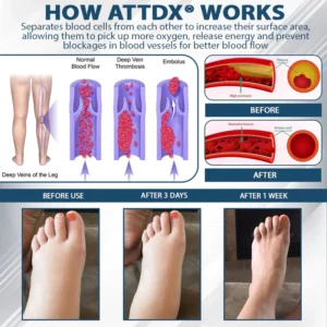 ATTDX® CuminBee Edema Relief Herbal Cream