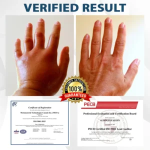 ATTDX® CuminBee Edema Relief Herbal Cream