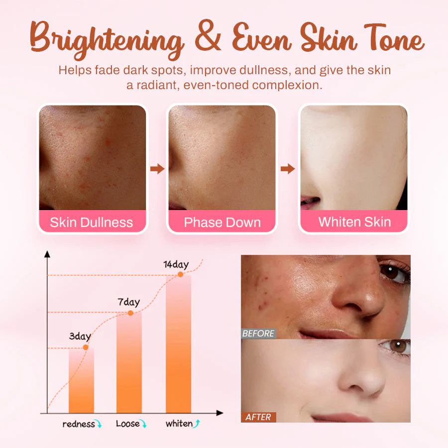 LOVILDS™ Whitening and Freckle - Removing Mask 3 LOVILDS™ Whitening and Freckle - Removing Mask